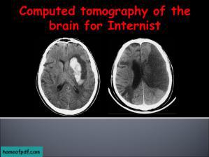 Computer tomography of the brainPDF.jpg